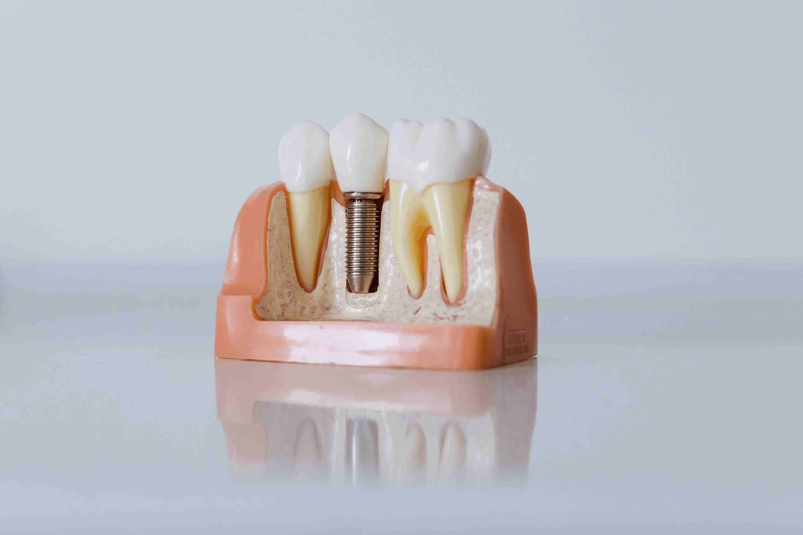 6 year molar
